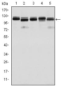 Figure 1: Western blot analysis using BMPR2 mouse mAb against Hela (1), A431 (2), NIH/3T3 (3), Cos7 (4) and PC-12 (5) cell lysate.