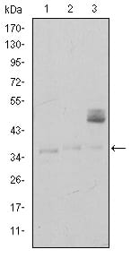 Figure 1: Western blot analysis using CD1A mouse mAb against K562 (1), RAJI (2), and MOLT4 (3) cell lysate.