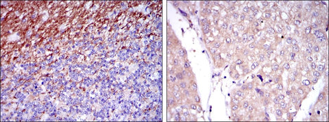 Figure 1: Immunohistochemical analysis of paraffin-embedded human cerebellum tissues (left) and human liver cancer tissues (right) using CD15 mouse mAb with DAB staining.