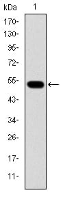 Figure 1: Western blot analysis using GCK mAb against human GCK (AA: 1-198) recombinant protein. (Expected MW is 48.2 kDa)