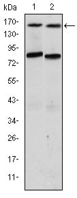 Figure 1: Western blot analysis using AIB1 mouse mAb against T47D (1) and MCF-7 (2) cell lysate.