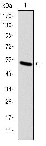 Figure 1: Western blot analysis using KID mAb against human KID (AA: 225-419) recombinant protein. (Expected MW is 47 kDa)