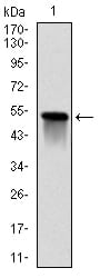 Figure 1: Western blot analysis using GSTM1 mAb against human GSTM1 (AA: 23-181) recombinant protein. (Expected MW is 25.7 kDa)