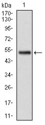 Figure 1: Western blot analysis using GSTM1 mAb against human GSTM1 (AA: 23-181) recombinant protein. (Expected MW is 25.7 kDa)