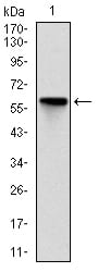 Figure 1: Western blot analysis using ROCK1 mAb against human ROCK1 (AA: 403-610) recombinant protein. (Expected MW is 158 kDa)