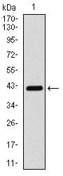 Figure 1: Western blot analysis using COTL1 mAb against human COTL1 (AA: 1-142) recombinant protein. (Expected MW is 16 kDa)
