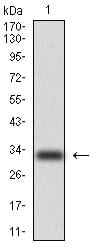 Figure 1: Western blot analysis using CK5 mAb against human CK5 (AA: 158-272) recombinant protein. (Expected MW is 33.3 kDa)