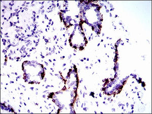 Figure 1: Immunohistochemical analysis of paraffin-embedded prostate tissues using CK5 mouse mAb with DAB staining.