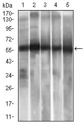 Figure 1: Western blot analysis using ALDH2 mAb against human ALDH2 recombinant protein. (Expected MW is 47.4 kDa)