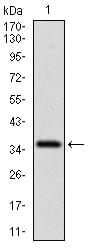 Figure 1: Western blot analysis using CD7 mAb against human CD7 recombinant protein. (Expected MW is 36.6 kDa)