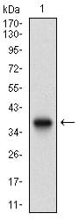 Figure 1: Western blot analysis using ACP5 mAb against human ACP5 recombinant protein. (Expected MW is 37.3 kDa)