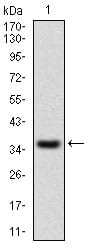 Figure 1: Western blot analysis using IL2RA mAb against human IL2RA recombinant protein. (Expected MW is 37.5 kDa)