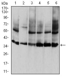 Figure 1:Western blot analysis using ANXA5 mouse mAb against HepG2 (1), PNAC-1 (2), NIH/3T3 (3), Hela (4), MCF-7 (5), and A431 (6) cell lysate.