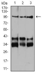 Figure 1:Western blot analysis using Neuropilin-1 mouse mAb against Jurkat (1), Hela (2), and HUVEC (3) cell lysate.