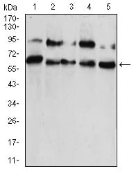 Figure 1:Western blot analysis using CBX2 mouse mAb against HUVEC (1), HEK293 (2), Hela (3), NIH/3T3 (4), and A431 (5) cell lysate.