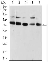 Figure 1:Western blot analysis using CBX2 mouse mAb against HUVEC (1), HEK293 (2), Hela (3), NIH/3T3 (4), and A431 (5) cell lysate.