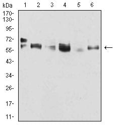 Figure 1:Western blot analysis using CK5 mouse mAb against A431 (1), MCF-7 (2), SK-Br-3 (3), Hela (4), Lncap (5), and HepG2 (6) cell lysate.