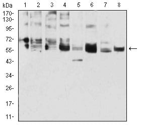 Figure 1:Western blot analysis using CK5 mouse mAb against A431 (1), 3T3-L1 (2), COS7 (3), MCF-7 (4), SK-Br-3 (5), Hela (6), Lncap (7), and HepG2 (8) cell lysate.