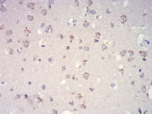 Figure 1:Immunohistochemical analysis of paraffin-embedded brain tissues using mTOR mouse mAb with DAB staining.