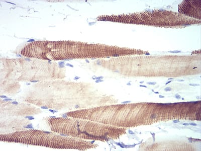 Figure 1:Immunohistochemical analysis of paraffin-embedded striated muscle tissues using ATG13 mouse mAb with DAB staining.