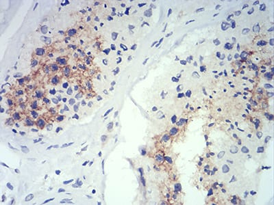 Figure 1:Immunohistochemical analysis of paraffin-embedded testis tissues using ATG14L mouse mAb with DAB staining.