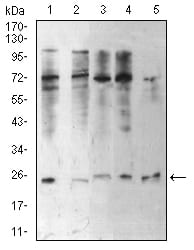 Figure 1:Western blot analysis using CBX5 mouse mAb against Hela (1), NIH/3T3 (2), K562 (3), MCF-7 (4), and A431 (5) cell lysate.