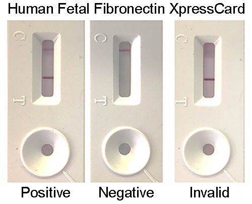 Human Fetal Fibronectin XpressCard (10 tests)