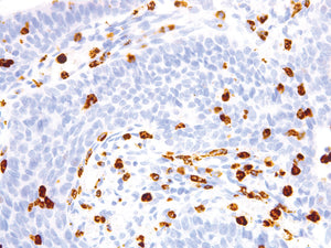Anti CD15/Leu-M1 Monoclonal Antibody