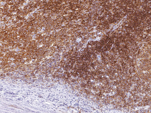 Anti-CD45 (LCA) Monoclonal Antibody
