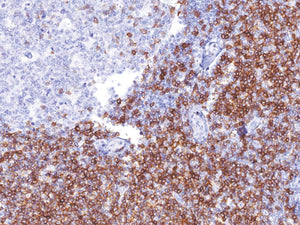 Anti-CD5 Monoclonal Antibody