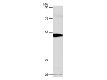 ACVR1B Polyclonal Antibody
