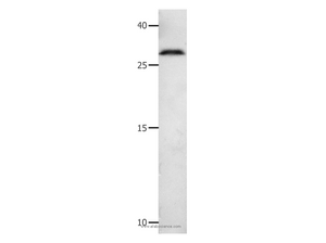 MMP7 Polyclonal Antibody
