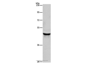 KRT40 Polyclonal Antibody