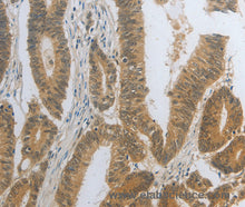 DNAJC7 Polyclonal Antibody