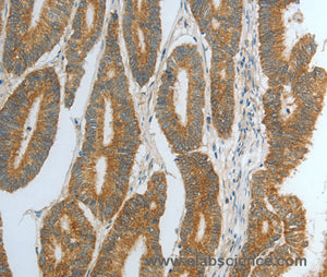 DNAJC10 Polyclonal Antibody