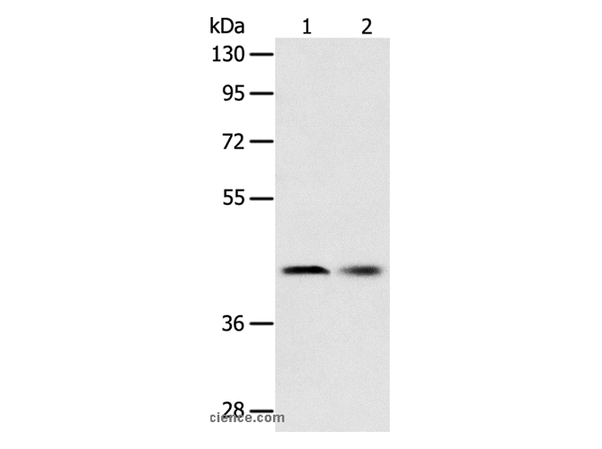 SERPINA5 Polyclonal Antibody