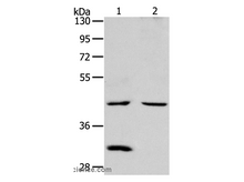 NCEH1 Polyclonal Antibody