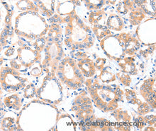AADACL2 Polyclonal Antibody