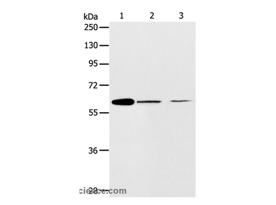 ABCE1 Polyclonal Antibody