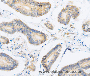 ABHD1 Polyclonal Antibody