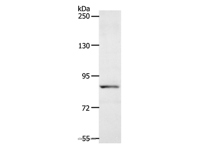 ACAD11 Polyclonal Antibody