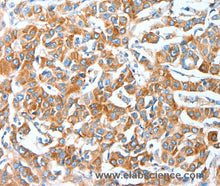 AFAP1 Polyclonal Antibody