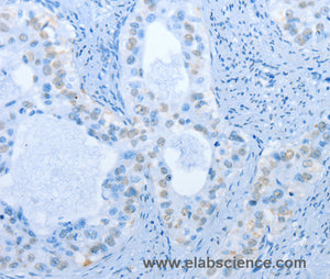 NAE1 Polyclonal Antibody