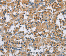 DNMT3A Polyclonal Antibody