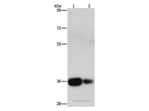 UCHL5 Polyclonal Antibody