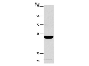 SPTLC1 Polyclonal Antibody