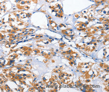 HK2 Polyclonal Antibody