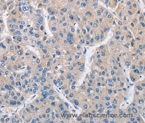 MTMR4 Polyclonal Antibody