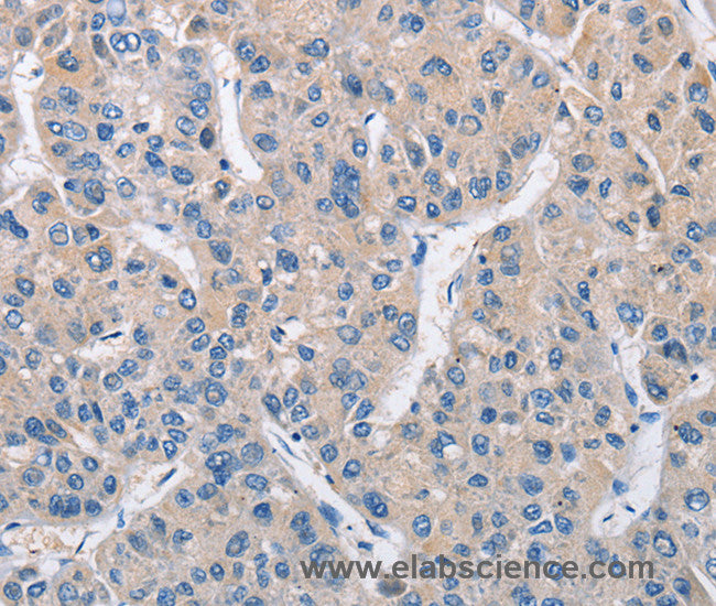 MTMR4 Polyclonal Antibody