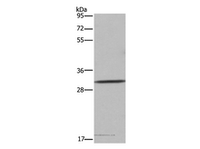 ASGR1 Polyclonal Antibody